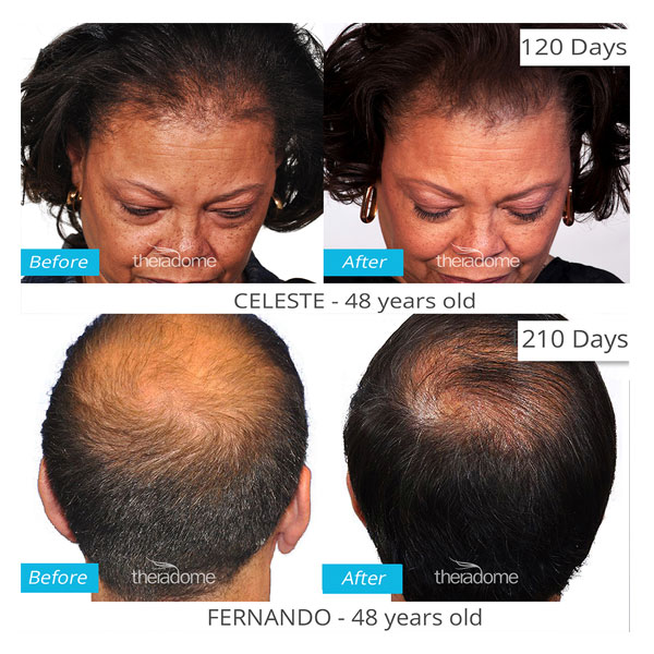 Theradome--before-after